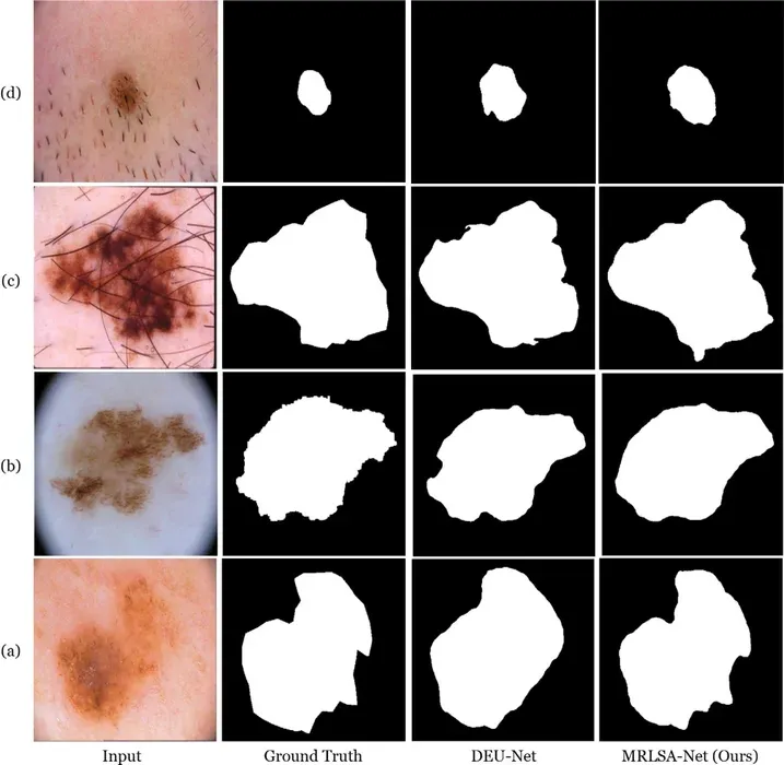 Figure 2 from “MRLSA-Net: An attention-enhanced framework for robust skin lesion segmentation”